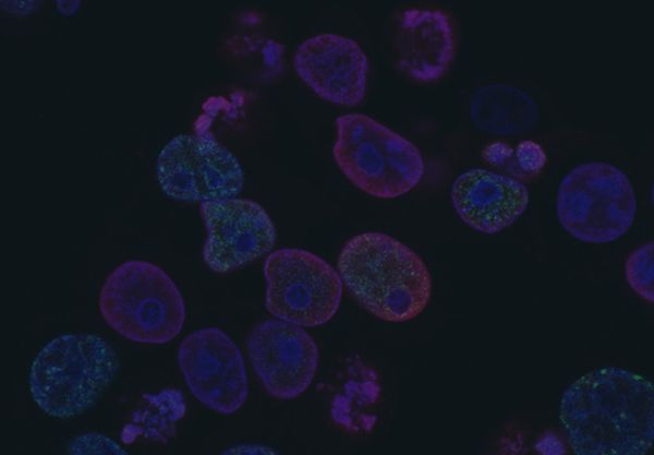 Cancer Control Research (NCI) Training Program photo